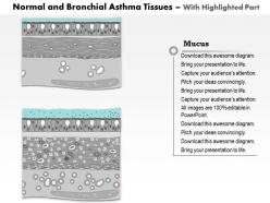 0514 normal and bronchial asthma tissues medical images for powerpoint