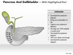 0514 pancreas and gallbladder medical images for powerpoint