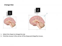 0514 pituitary gland medical images for powerpoint