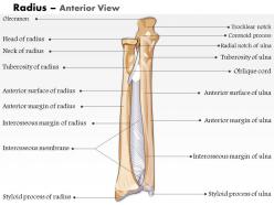 0514 radius anterior view medical images for powerpoint