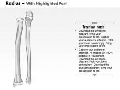 0514 radius ulnar view medical images for powerpoint