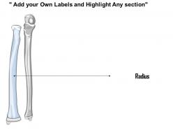 0514 radius ulnar view medical images for powerpoint