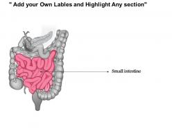 0514 small intestine medical images for powerpoint