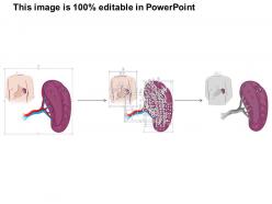 0514 spleen medical images for powerpoint