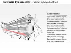 0514 the extrinsic eye muscles medical images for powerpoint
