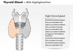 0514 thyroid gland medical images for powerpoint