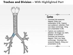 0514 trachea and divisions medical images for powerpoint