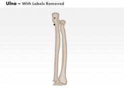 0514 ulna posterior medical images for powerpoint