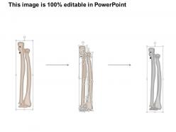0514 ulna posterior medical images for powerpoint