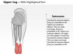 0514 upper legs posterior view medical images for powerpoint