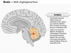 0614 brain sagittal view medical images for powerpoint