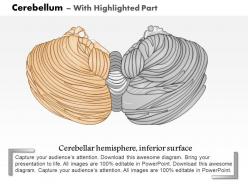 0614 cerebellum medical images for powerpoint