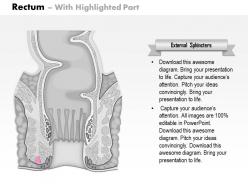 0614 diagram of rectum medical images for powerpoint