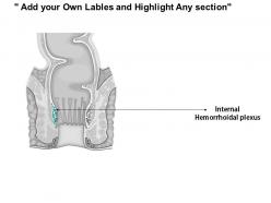0614 diagram of rectum medical images for powerpoint