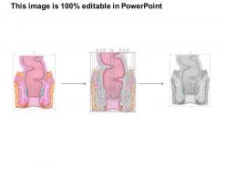 78252185 style medical 1 digestive 1 piece powerpoint presentation diagram template slide