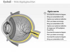 0614 eyeball transverse section medical images for powerpoint
