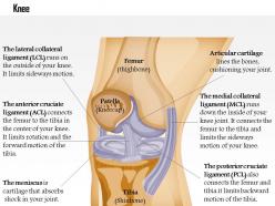 0614 knee medical images for powerpoint