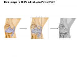 0614 knee medical images for powerpoint