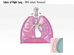 0614 lobes of right lung medical images for powerpoint
