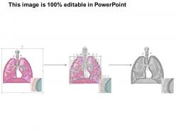 0614 lobes of right lung medical images for powerpoint