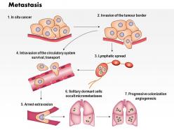 0614 metastasis biology medical images for powerpoint