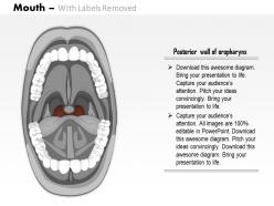 0614 mouth medical images for powerpoint