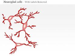 0614 neuroglial cells microglia medical images for powerpoint