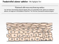 0614 pseudostratified columnar epithelium medical images for powerpoint