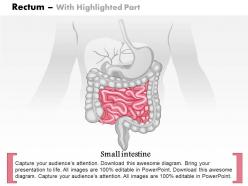 31425875 style medical 1 digestive 1 piece powerpoint presentation diagram infographic slide