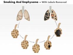 0614 smoking and emphysema medical images for powerpoint