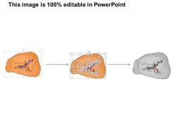 0614 spleen immune medical images for powerpoint