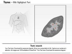 0614 thymus medical images for powerpoint