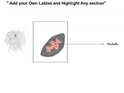 0614 thymus medical images for powerpoint