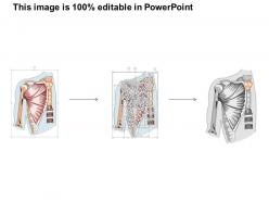 70552099 style medical 1 musculoskeletal 1 piece powerpoint presentation diagram template slide