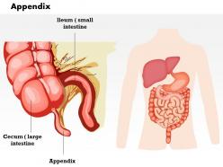 0714 appendix medical images for powerpoint