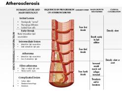 0714 atherosclerosis medical images for powerpoint