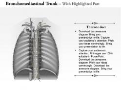 0714 bronchomediastinal trunk medical images for powerpoint