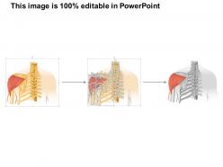 7762063 style medical 1 musculoskeletal 1 piece powerpoint presentation diagram infographic slide