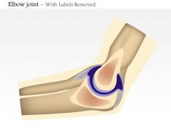 0714 elbow joint medical images for powerpoint
