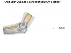 0714 elbow joint medical images for powerpoint