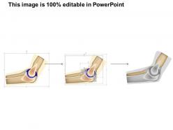 13940654 style medical 1 musculoskeletal 1 piece powerpoint presentation diagram infographic slide