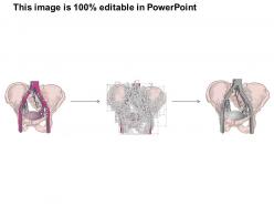 39826698 style medical 2 immune 1 piece powerpoint presentation diagram infographic slide