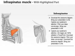 0714 infraspinatus muscle medical images for powerpoint