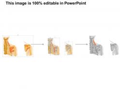 0714 infraspinatus muscle medical images for powerpoint