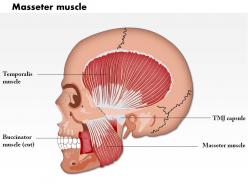 0714 masseter muscle medical images for powerpoint