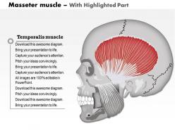 0714 masseter muscle medical images for powerpoint