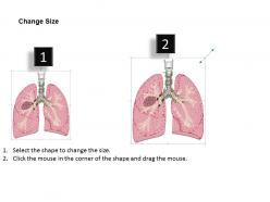 78759563 style medical 2 immune 1 piece powerpoint presentation diagram infographic slide
