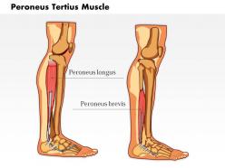 0714 peroneus tertius muscle medical images for powerpoint