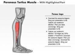 0714 peroneus tertius muscle medical images for powerpoint