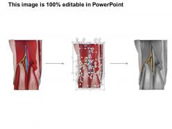 48142264 style medical 2 immune 1 piece powerpoint presentation diagram infographic slide